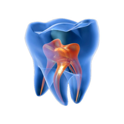 ENDODONTICS