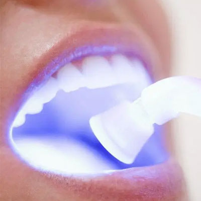 LASER DENTISTRY