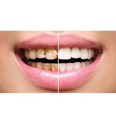 RESTORATIVE DENTISTRY